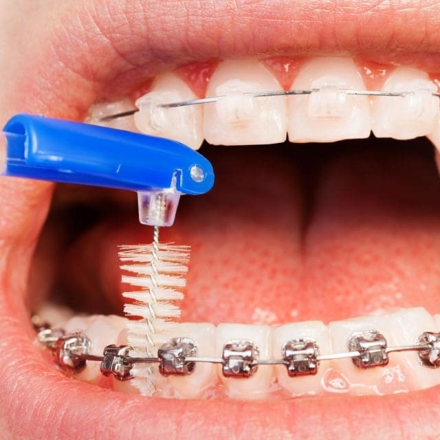 interdental brush