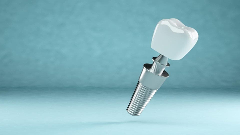 implant diş fiyatları