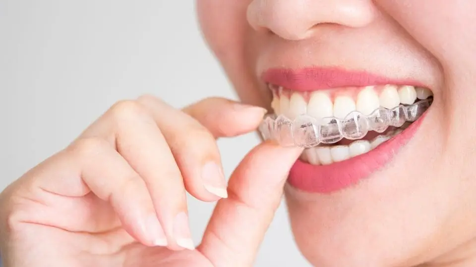 invisalign transparent plate