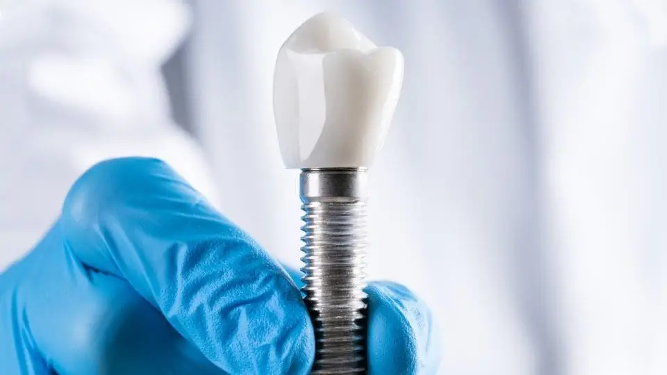 implant fiyatları