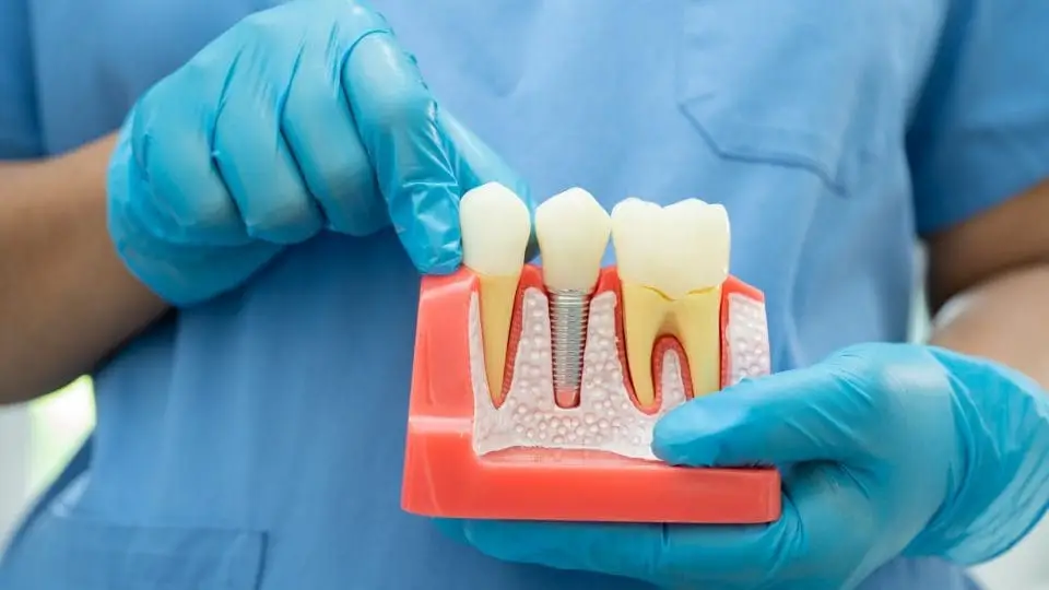 implant treatment