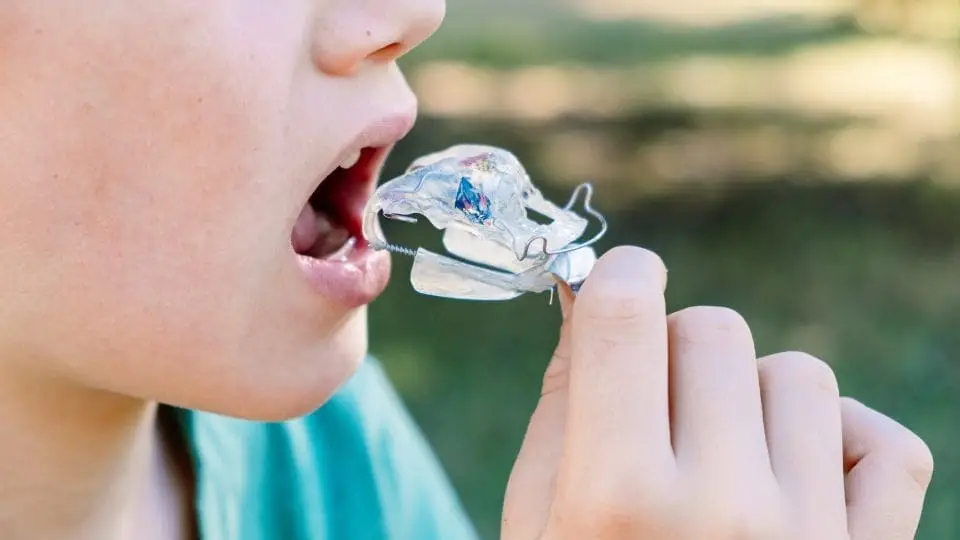 palate jaw expansion