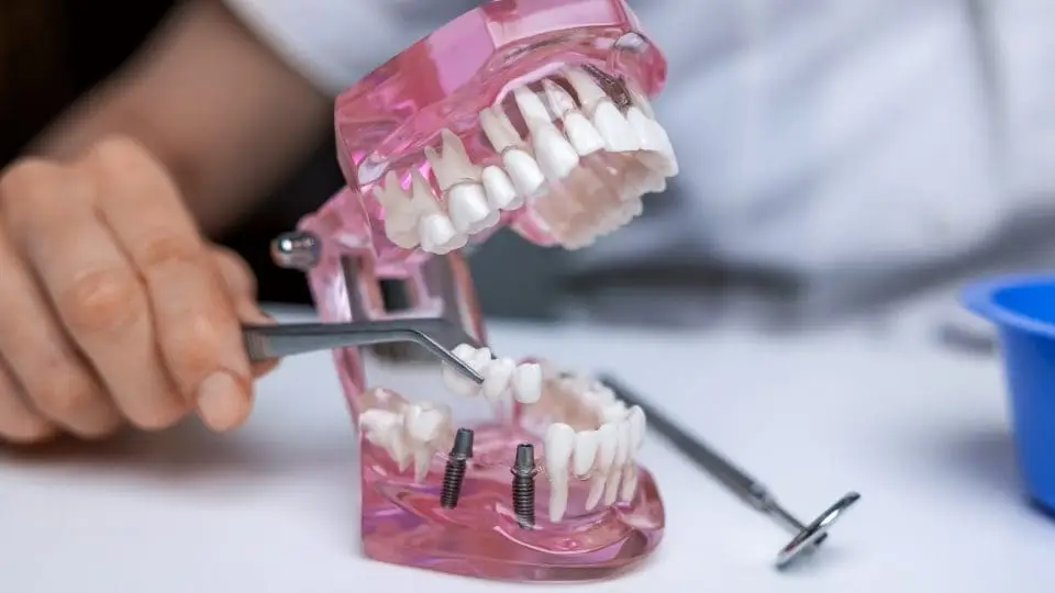 dental implant treatment