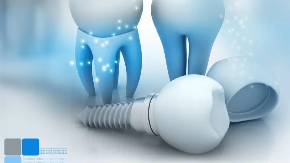implant dental akademya